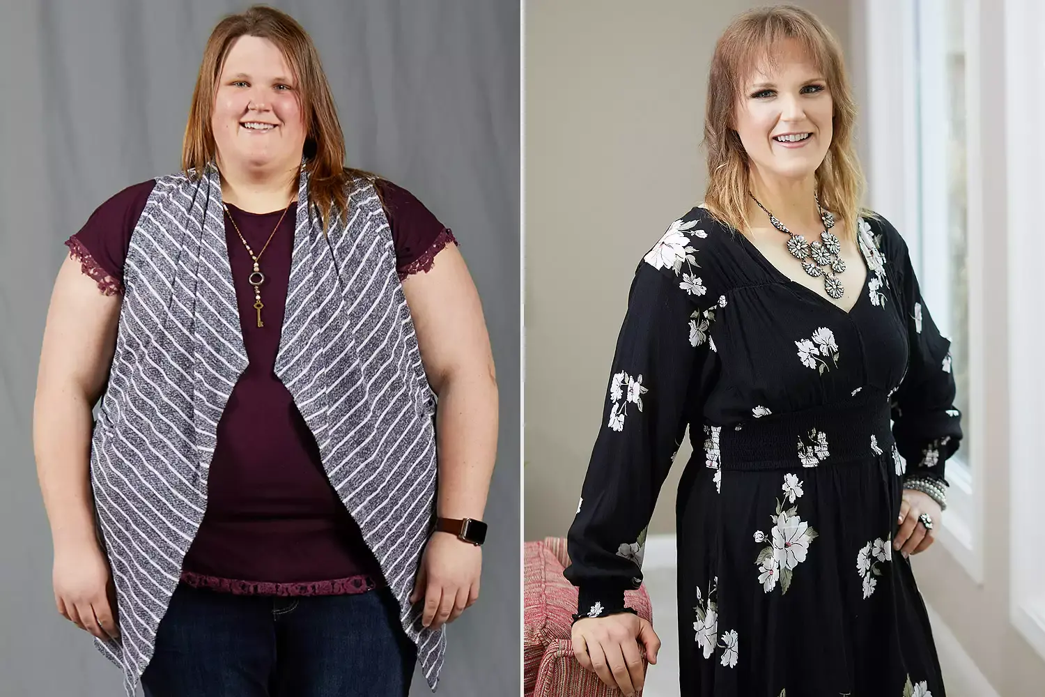 Before and after weight loss