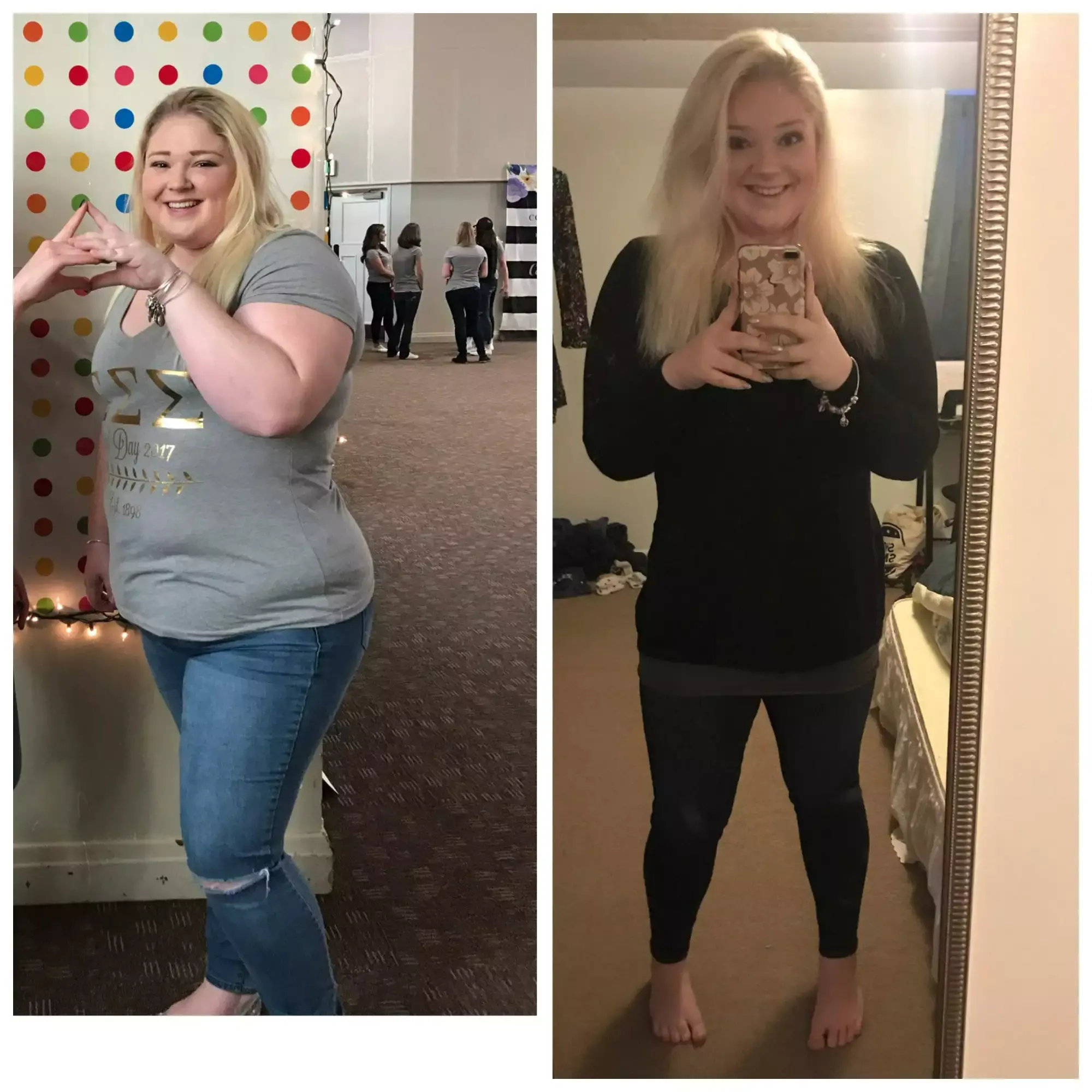 Before and after weight loss