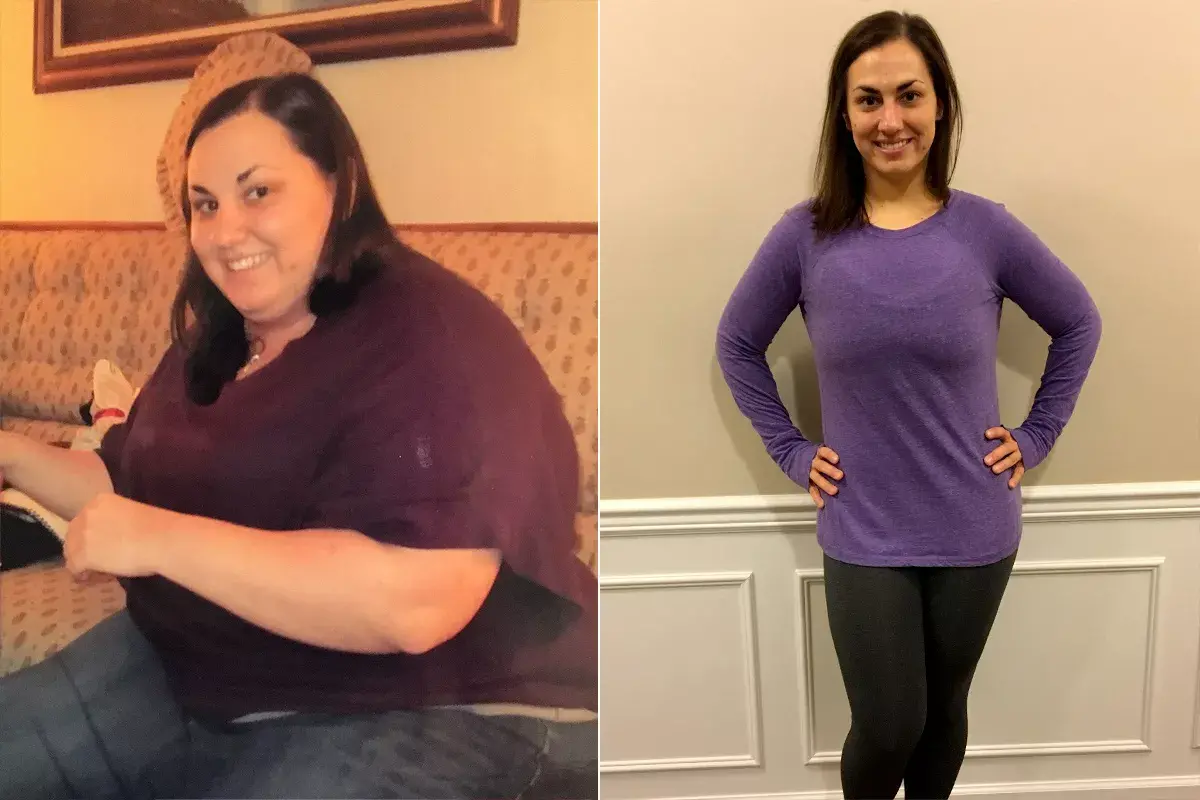 Before and after weight loss